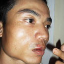 Thai phụ mất con tố bị bảo vệ bệnh viện “tấn công”