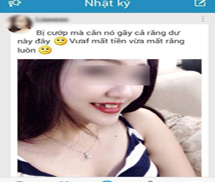 Cô gái vô tư chụp ảnh khoe chiến tích 'cắn tên cướp nên bị mất răng'