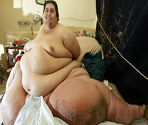 Người béo nhất hành tinh vừa qua đời ở tuổi 49