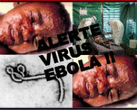 Đại dịch Ebola: 90% cái ch.ết bắt nguồn từ đâu?