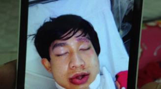 Ca sĩ nhóm nhạc HKT bị tai nạn nghiêm trọng