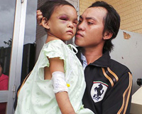 Vụ bạo hành bé 4 tuổi: “Con muốn ở với cha, không ở với mẹ”