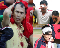 Những vụ ẩu đả kinh hoàng của CĐV trong bóng đá Việt Nam