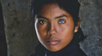 Cô gái có đôi mắt hai màu kỳ lạ ở Ninh Thuận