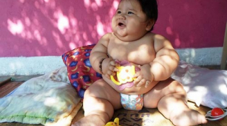 Hình ảnh của những em bé béo nhất thế giới