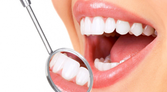 Cách đơn giản nhất để phòng ngừa cao răng ai cũng nên biết