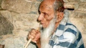 Cụ ông 102 tuổi bất ngờ mọc sừng dài nửa mét trên đầu