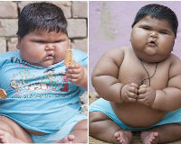 Kỳ lạ: Bé gái người Ấn Độ 10 tháng tuổi nặng gần 19 kg