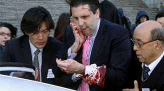 Bị rạch mặt, sức khỏe Đại sứ Mỹ tại Hàn Quốc ra sao?