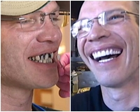 Vị khách hào phóng boa nhân viên 500 triệu để thẩm mỹ răng