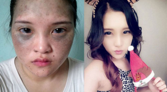 'Soi' độ lột xác của 10 thiếu nữ Việt sau khi dao kéo