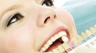 Tẩy răng không đúng cách làm viêm lợi, chết tủy