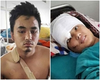 Động đất Nepal: Cặp tình nhân rơi từ tháp 60m thoát chết kỳ diệu