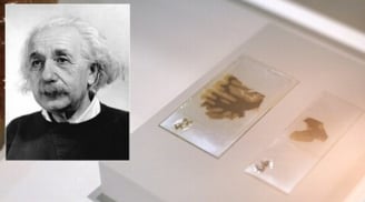 Chuyện ly kỳ về bộ não thiên tài bị đánh cắp của Einstein