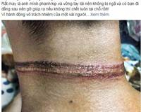 Xôn xao bức ảnh bị dây điện thắt cổ giữa đường ở Hà Nội