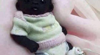 Sự thực bàng hoàng về em bé Nam Phi đen nhất Thế giới