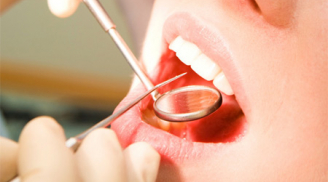 Hàng chục nghìn người có thể bị nhiễm HIV khi đi chữa răng