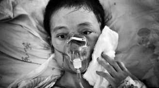 Kinh hoàng: Cô gái xinh đẹp tử vong vì hàng trăm con giòi ký sinh
