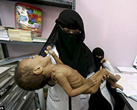 Rơi nước mắt cảnh hàng triệu người đói ăn vì nội chiến ở Yemen