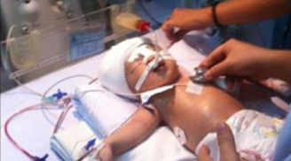 Báo chí thế giới sốc về vụ bé trai 11 ngày tuổi bị đâm xuyên đầu