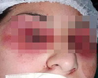 Kinh hoàng: Thiếu nữ bị gia đình móc mắt dã man