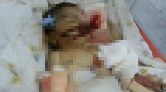 Bé sơ sinh tử vong thương tâm vì bị chuột cắn trong bệnh viện