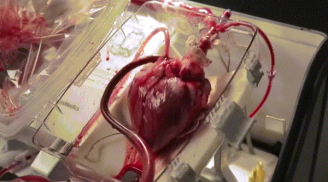 Nổi da gà xem quả tim người đập thình thịch bên ngoài cơ thể