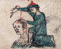 Phát hoảng với cách chữa bệnh đáng sợ thời Trung Cổ