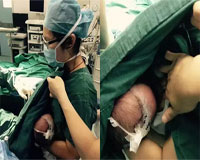 Nữ y tá vừa phẫu thuật vừa cho bú trên bàn mổ gây xúc động