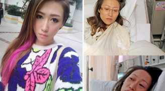 Bị tung ảnh khỏa thân, người mẫu Hong Kong cắt tay tự tử