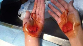 Bỏ tiết, học sinh bị cô giáo bắt đi bằng hai tay đến toé máu