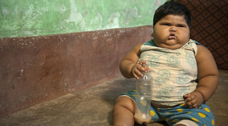 Bé gái 18 tháng tuổi nặng 24 kg khiến bố mẹ phá sản vì ăn nhiều