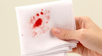 Mẹo nhỏ loại bỏ vết máu dính trên vải nhanh chóng