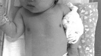 Bé gái 4 tuổi bẻ gãy tay em trai mới sinh vì bị bà trêu “ra rìa”