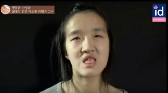 Bà mẹ Hàn Quốc xinh như hot girl sau khi ‘dao kéo’