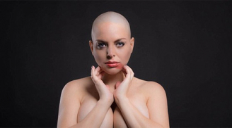 Người mẫu 'siêu vòng 3' bị ung thư vẫn nghiện thẩm mỹ