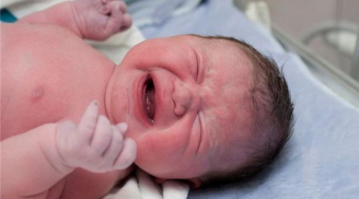 Các biến chứng 'bất ngờ' xảy ra trong khi sinh nở