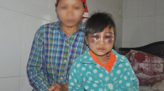 Bé gái bị đánh tím mắt không phải là nạn nhân duy nhất của cô Trà