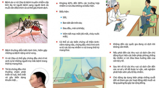 Khuyến cáo của Bộ Y tế với phụ nữ mang thai ứng phó virus Zika