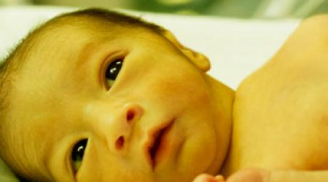 Tất tần tật về vàng da ở trẻ sơ sinh