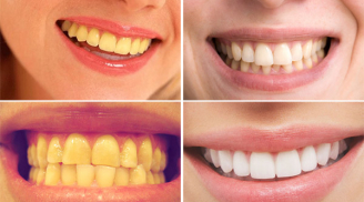 'Bí mật' giúp răng trắng bóng không cần tới nha sỹ