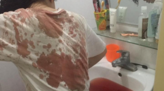 Cô gái bị giật túi xách 'suýt bỏ mạng' giữa phố Hà Nội