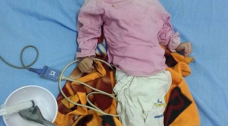 Rơi nước mắt hình ảnh bé 14 tháng tuổi chỉ nặng 3,5 kg vì… đói