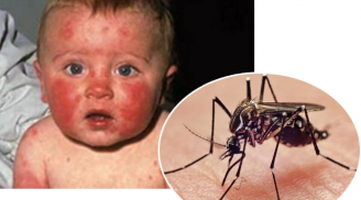 Thử nghiệm thành công vắcxin ngừa virus Zika trên động vật