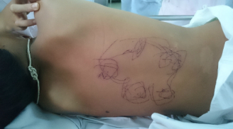 Bé trai bị rạch dao lam để vẽ bùa chữa viêm não Nhật Bản
