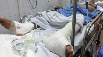 Bệnh viện Việt Đức công khai xin lỗi vụ mổ nhầm chân