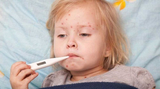 Khi trẻ bị sốt phát ban nên chăm sóc cho trẻ như thế nào?