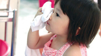 Khi trẻ bị đau mắt đỏ nên chăm sóc trẻ như thế nào?
