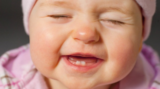 Vì sao bác sĩ khuyên bạn giữ lại răng sữa của trẻ?