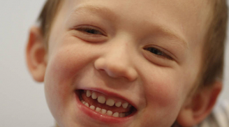 Quy trình bảo quản răng sữa có thể cứu tính mạng con bạn sau này